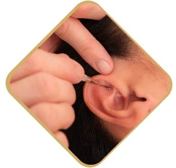 réflexologie combinée sur oreille